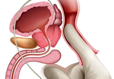 Зачем делать массаж простаты? Ответ докмед уролога | Пикабу