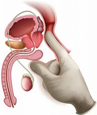 Где сделать массаж простаты и заказать на дом в Ростове