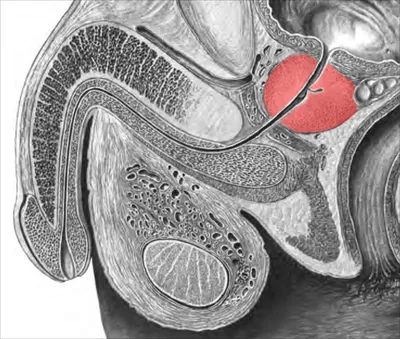 Массаж простаты у мужчин в Хабаровске - Медикъ