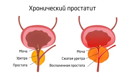 Массажер простаты с приложением и дистанционным управлением, вибромассажер  телескопический анальный с эрекционными кольцами, анальный стимулятор -  купить с доставкой по выгодным ценам в интернет-магазине OZON (1176856649)