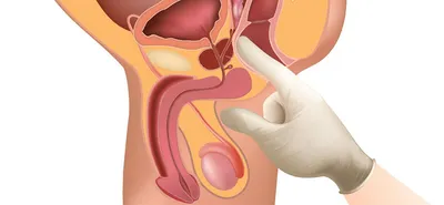 Массаж простаты картинки