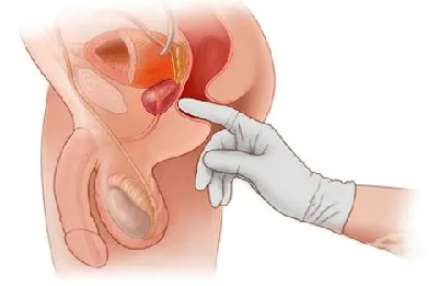 Массаж простаты (предстательной железы), цена от 1100 руб в Москве, клиника  Южный