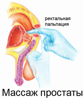 Зачем Делают Массаж Простаты: Цель Массажа (Как Он Проходит)