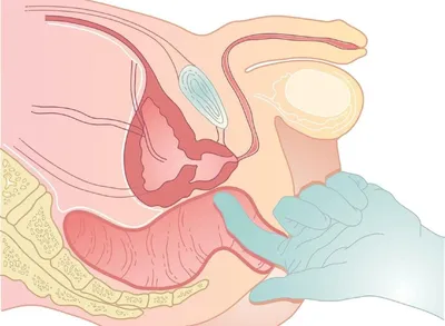 Массаж простаты