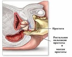 Сравнительный анализ массажа простаты | Доктор Колосова / Уролог-Андролог |  Дзен