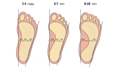 Техника массажа ног при плоскостопии у детей - 
