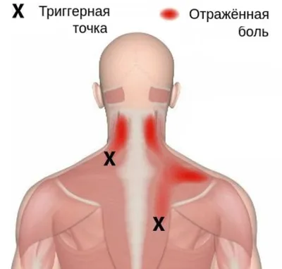 Letique_nsk - Массаж сухой щеткой проводится исключительно по сухой коже.  Лучше это делать за полчаса🕑 до принятия душа🚿 или ванны🛀, чтобы потом  смыть с тела отделившиеся ороговевшие клетки ⠀ 📍Все движения должны