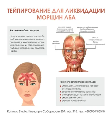 Как бороться с морщинами на лбу? Тейпирование и контроль мимики - Студия  эстетики тела Марины Костровой