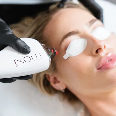 Moxi Laser Treatment • Skin Pharm