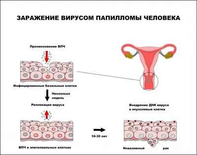 Почему, если папилломы не удалять, их станет больше? | Дерматолог Ольга  Антонова | Дзен