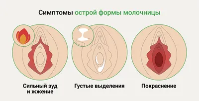 Молочница у женщин симптомы и быстрое и эффективное лечение