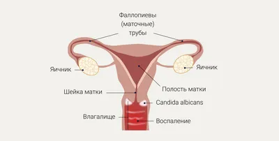 Хроническая молочница: схема лечения, свечи, профилактика