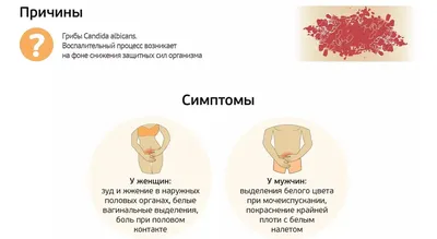 7 симптомов молочницы у женщин: как проявляются симптомы кандидоза и что  надо делать в домашних условиях