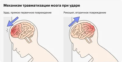 Мозг детский рисунок (69 фото) » Рисунки для срисовки и не только