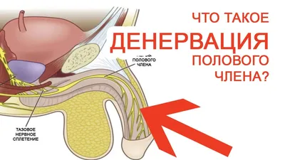 Коррекция искривления полового члена: восстановление мужского здоровья и  уверенности