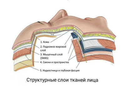 Лицевые связки: каркас лица