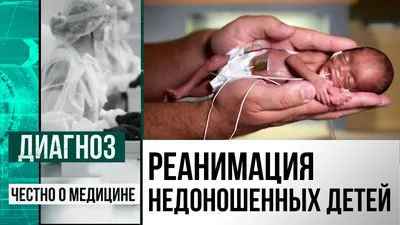 17 ноября - Международный день недоношенных детей - Агентство социальной  информации