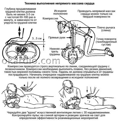 ПРАВИЛА И ТЕХНИКА ПРОВЕДЕНИЯ ИСКУССТВЕННОГО ДЫХАНИЯ И НЕПРЯМОГО МАССАЖА  СЕРДЦА