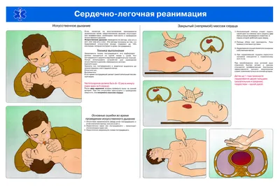 Национальный центр массового обучения » 19. Научные и практические основы »  9. Безвентиляционный вариант реанимации