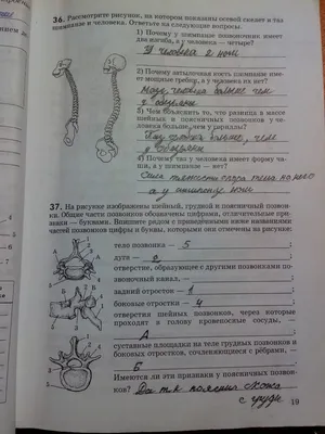 Грыжа шейного отдела позвоночника - Клиника вертеброневрологии