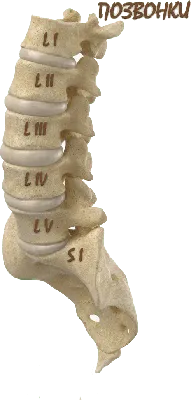 Грыжа поясничного отдела позвоночника - Клиника вертеброневрологии
