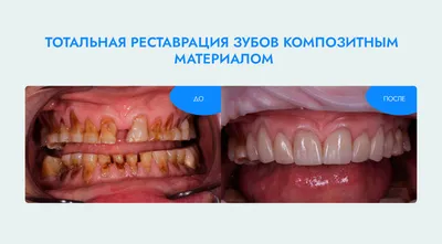 Зубы - сколько зубов у человека? Номера зубов в стоматологии |   | Дзен