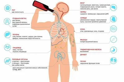 30 доказанных фактов о вреде употребления алкоголя
