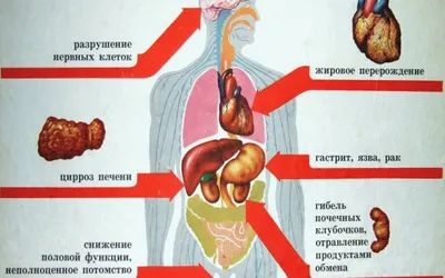 Памятка о вреде употребления алкоголя! | Администрация Почепского сельского  поселения Лискинского района