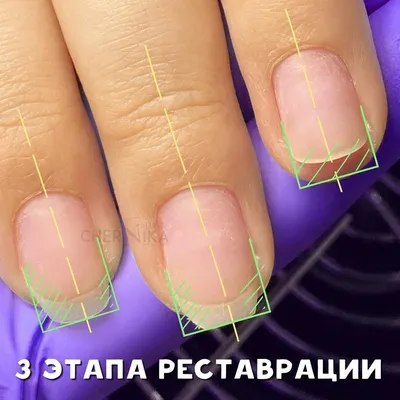 Гель для наращивания ногтей TNL Acryl gel - «Акригель TNL вернёт вам  потерянный ноготь» | отзывы