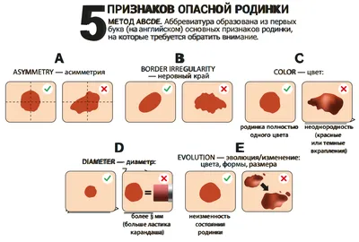 Опасны ли родинки — блог медицинского центра ОН Клиник