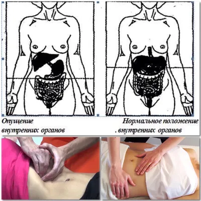 УЗИ (ультразвуковое исследование) органов брюшной полости - «УЗИ органов  брюшной полости прохожу с детства 2 раза в год. Какие органы показывает?  Цена? Какая подготовка? Страшно ли?» | отзывы