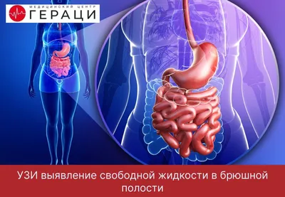 МРТ брюшной полости | Стоимость МРТ брюшной полости в Махачкале