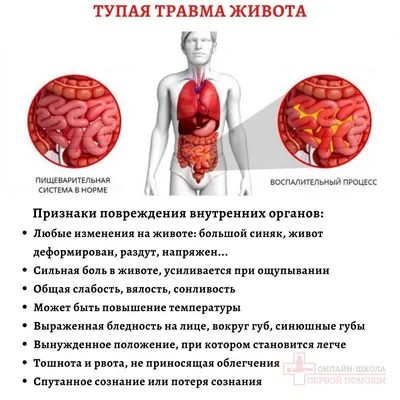 Мужские брюшные органы, живот, цифровая иллюстрация . — Большой кишечник,  Вид спереди - Stock Photo | #308609356