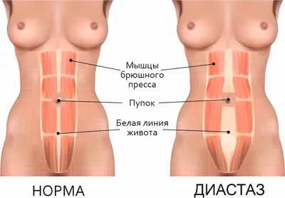 Женская анатомия брюшной полости и внутренних органов, компьютерная  иллюстрация . — Озил работает, Цифровая - Stock Photo | #308621952