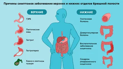 КАК ПОМОЧЬ СЕБЕ ПРИ ОПУЩЕНИИ ВНУТРЕННИХ ОРГАНОВ?/ Животам НЕТ! // Владимир  Животов - YouTube