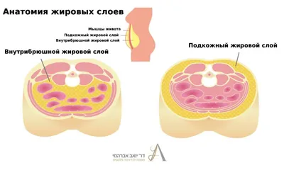 Блог - подтяжка живота - ד״ר יואב אברהמי