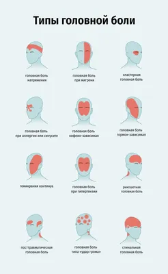 Как избавиться от головной боли? - статьи от компании Еламед