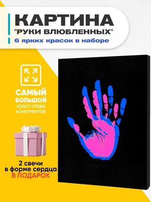 Остеохондроз руки: причины и симптомы, лечение остеохондроза в Москве по  низким ценам