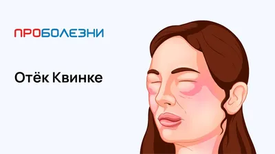 Отек Квинке - первая помощь и лечение