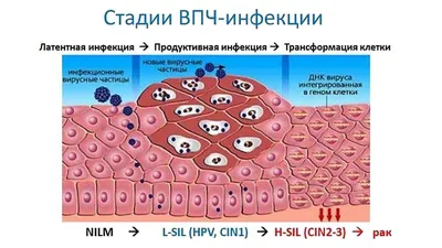 вакцинация против вируса папилломы человека – КГБУЗ "Детская городская  клиническая больница №9" город Хабаровск