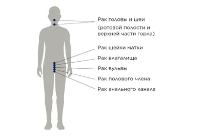 Вирус папилломы человека: где можно заразиться, какие виды способны  привести к раку и кому нужна вакцинация