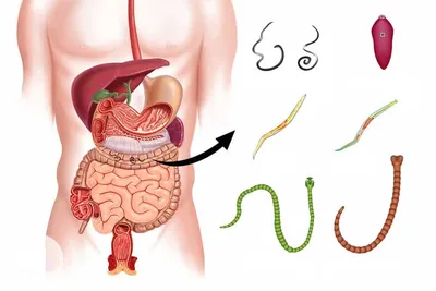 Какие редкие паразиты могут жить в теле человека? - 