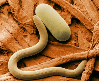 Исследователи выяснили, как паразиты научились жить без кислорода