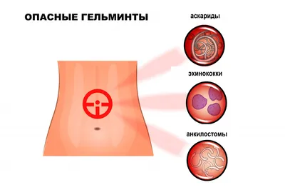 Иллюстрация Гельминтов Цветном Фоне Паразиты Организме Человека стоковое  фото ©NewAfrica 619906806