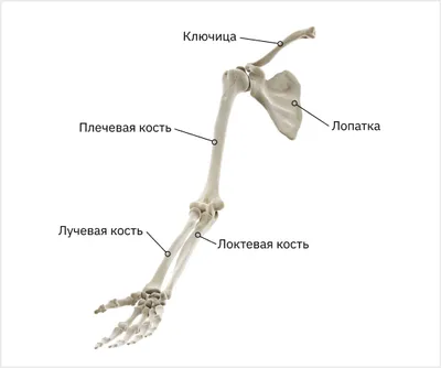 Лечение перелома кисти - пястной, со смещением | Dr_Zasypka