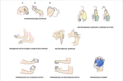 Переломы кисти: симптомы, причины, признаки, виды и методы лечения переломов  в Центре Хирургии «СМ-Клиника»