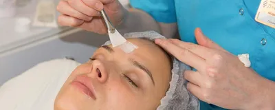 Пилинг лица в Киеве: цена, запись онлайн - Coolaser Clinic