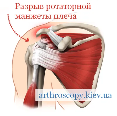 Болит плечо: причины, лечение боли в плечевом суставе в Киеве