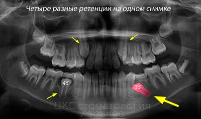 Плохие Гены" провели съезд