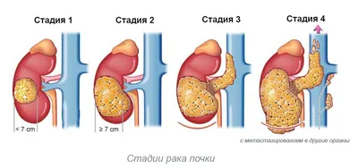 Весна, пиво, почки набухают. | Иль | Дзен